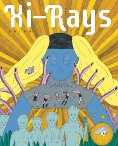 Xi Rays fr